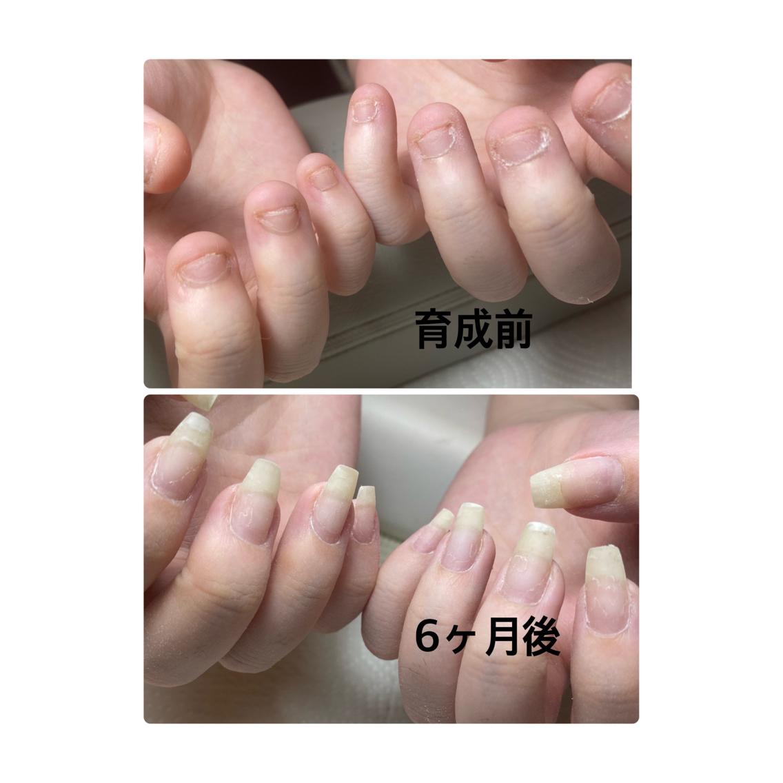 深爪さん　10本長さ出しワンカラーの写真