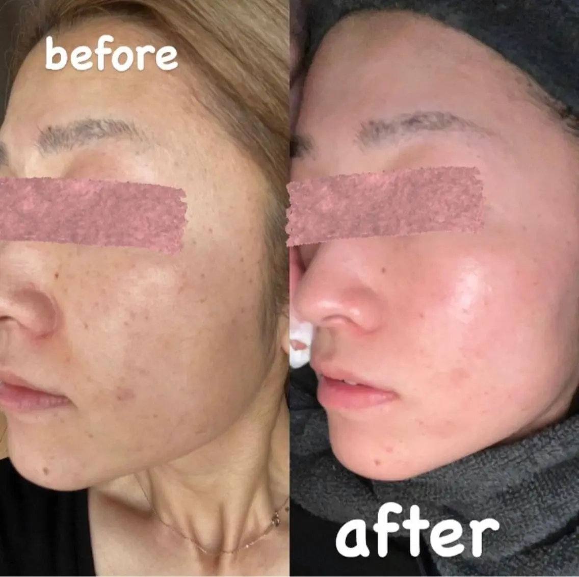beauty lanaのエステ・リラクイメージ