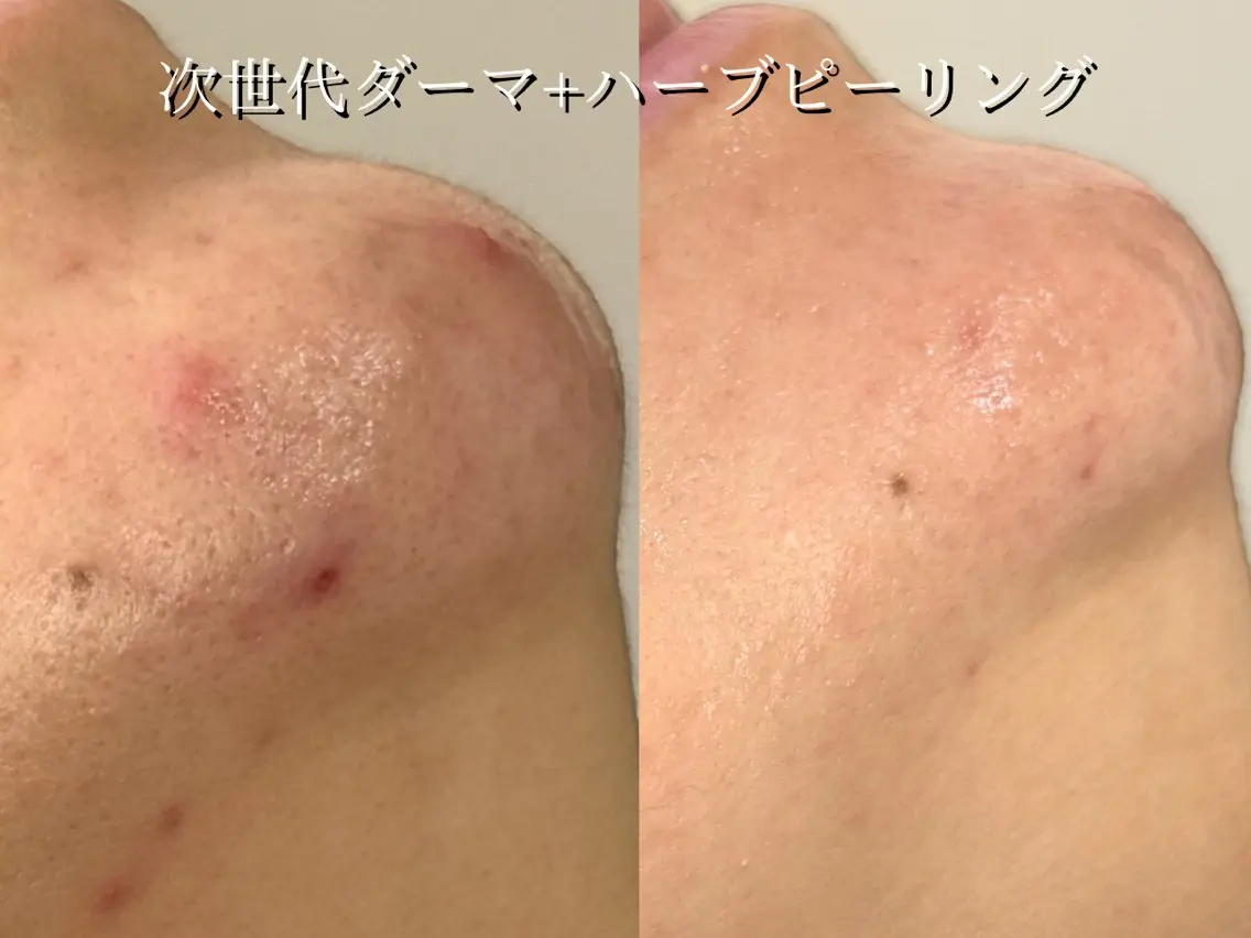 エステ Rairy Salon富士見町のエステ・リラクイメージ