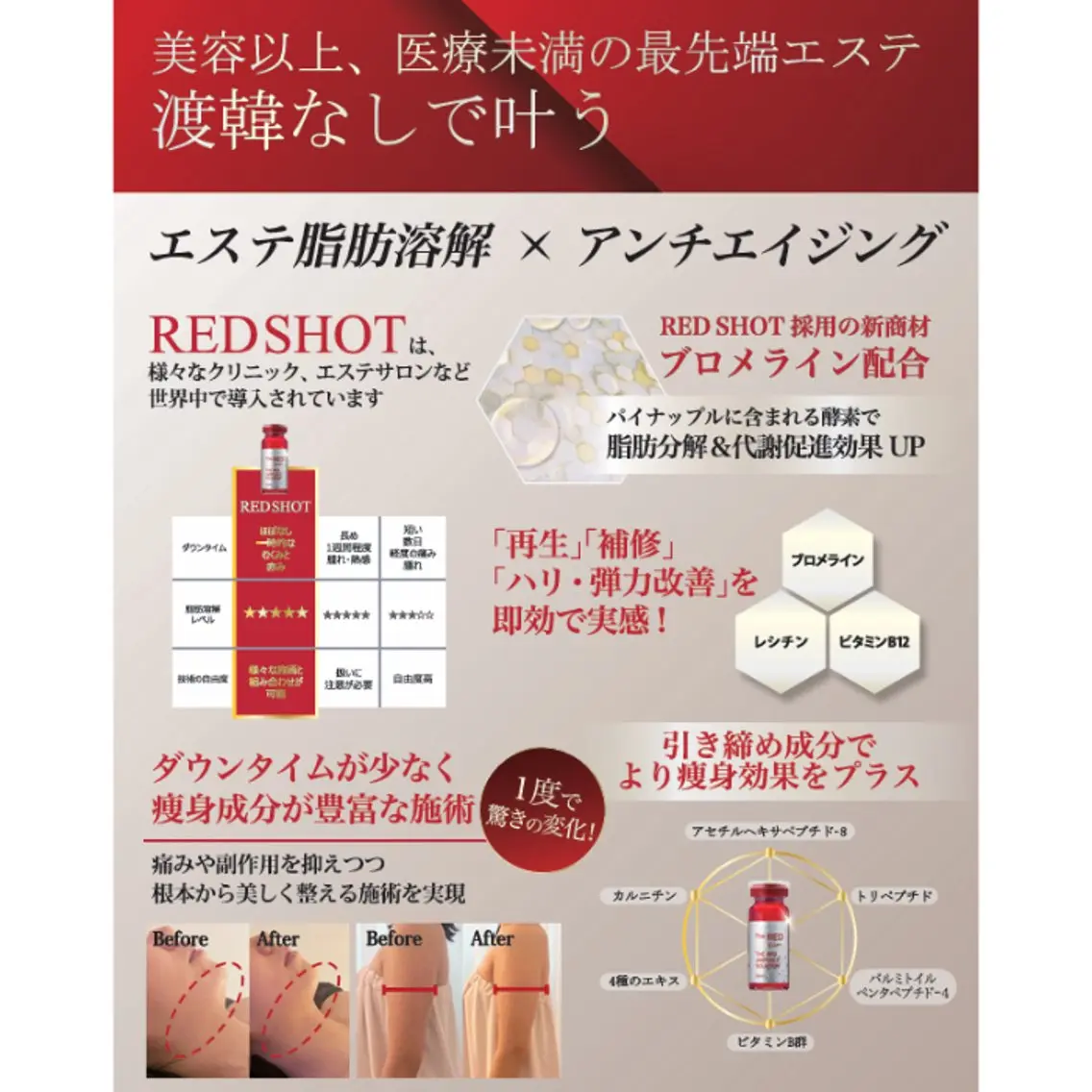 レッドショットの写真