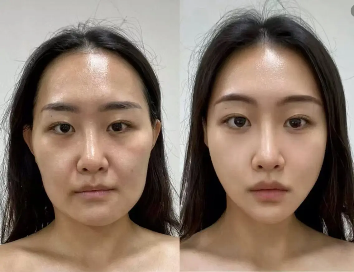 マツエク・マツパ エステ 愛維美水光専門店 川崎彩鳳のエステ・リラクイメージ