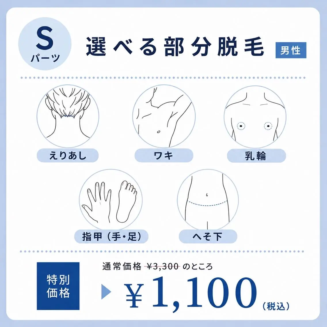 【7月限定】選べるSパーツ脱毛(男性)¥3,300→¥1,100の写真