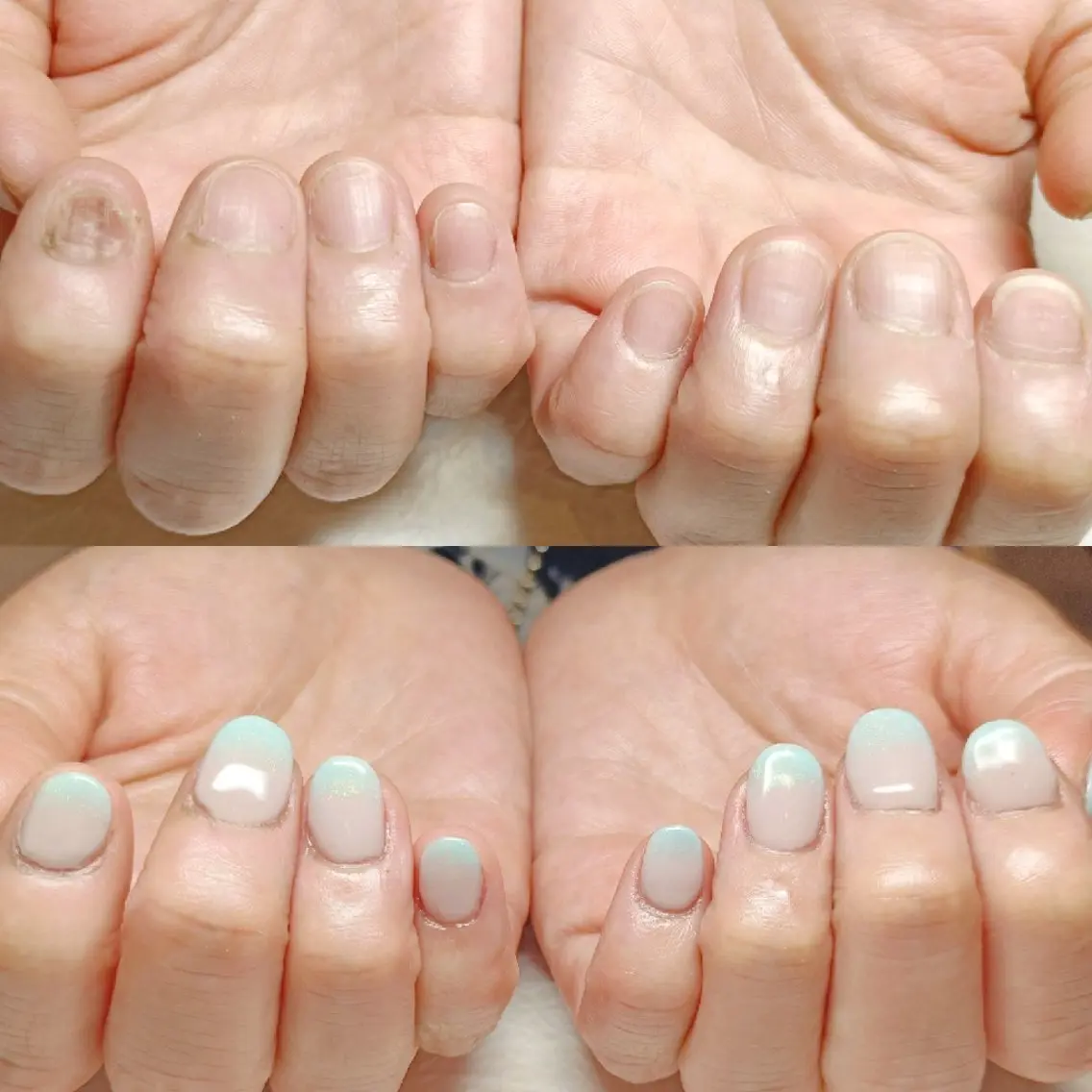 ネイル ハンドネイル ハンドケア 深爪矯正/爪育成ケア manie nailのネイルデザイン