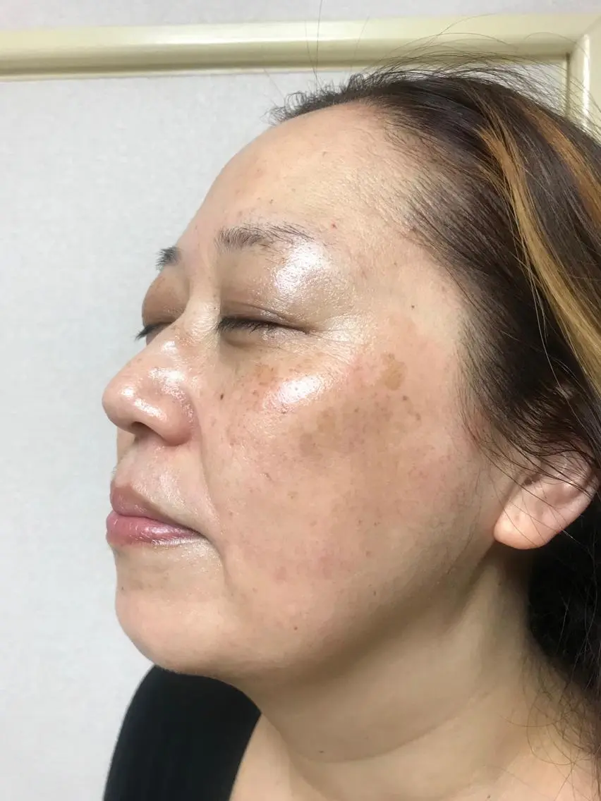 紫外線☀️が弱いからこそ、この季節に。美白ケアは、おすすめです🤗の写真