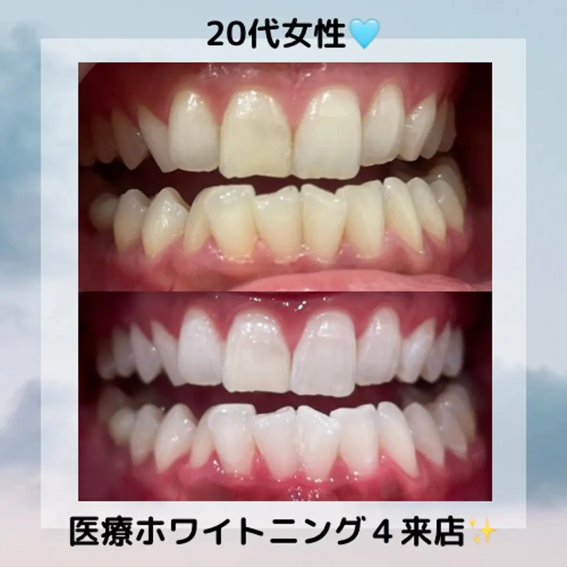 Kaula ホワイトニング🦷✨のエステ・リラクイメージ