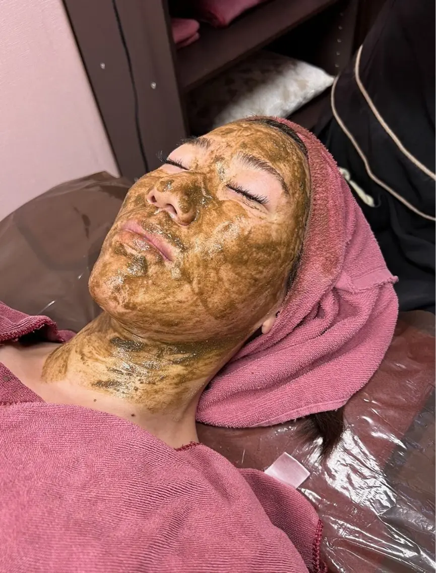【ハーブピーリング🌿】剥離、ダウンタイム、赤み、痛み、乾燥 すべてない!★肌再生集中ケア★国産ハーブの写真
