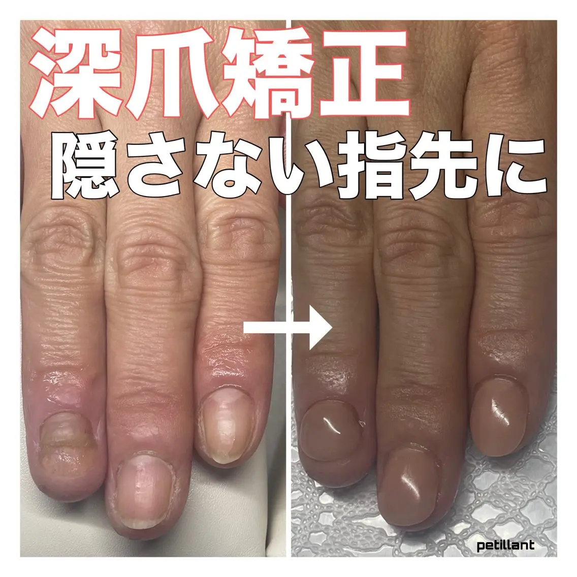 ネイル nail salon petillantのネイルデザイン