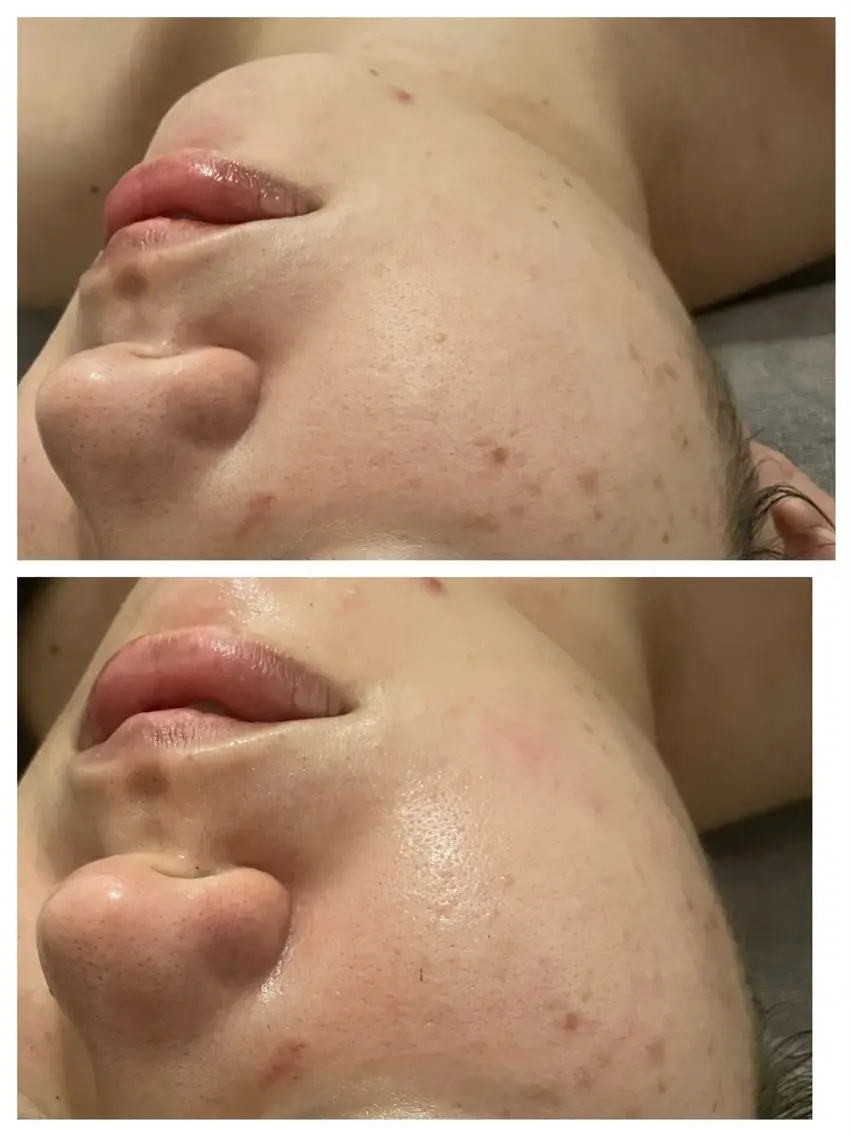 アロマオイルリンパ マッサージ💆‍♀️のエステ・リラクイメージ