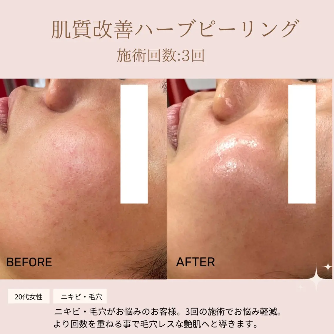 肌質改善専門サロン Bellmi/心斎橋のエステ・リラクイメージ