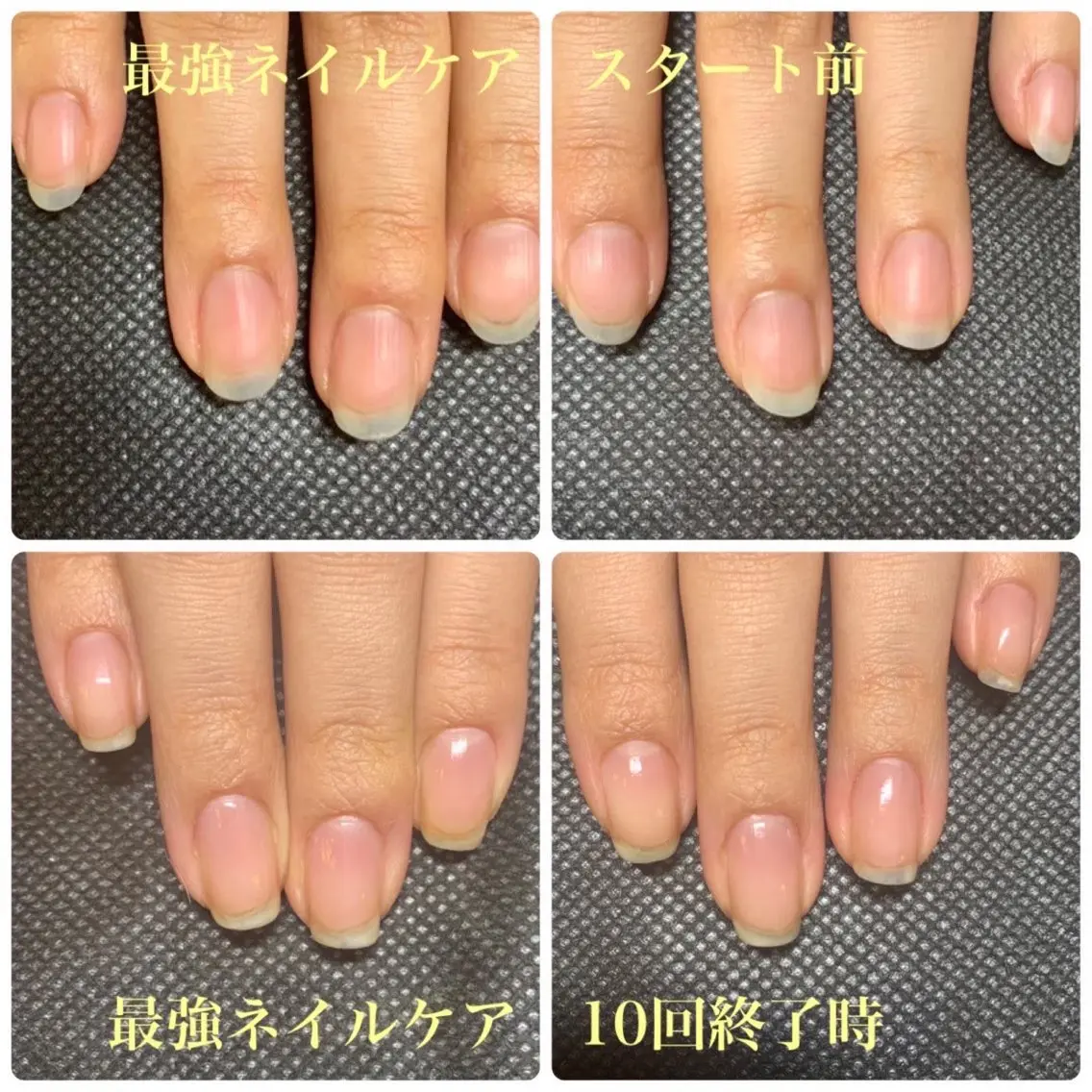 ネイル 地爪育成💅 kanaoanailのネイルデザイン