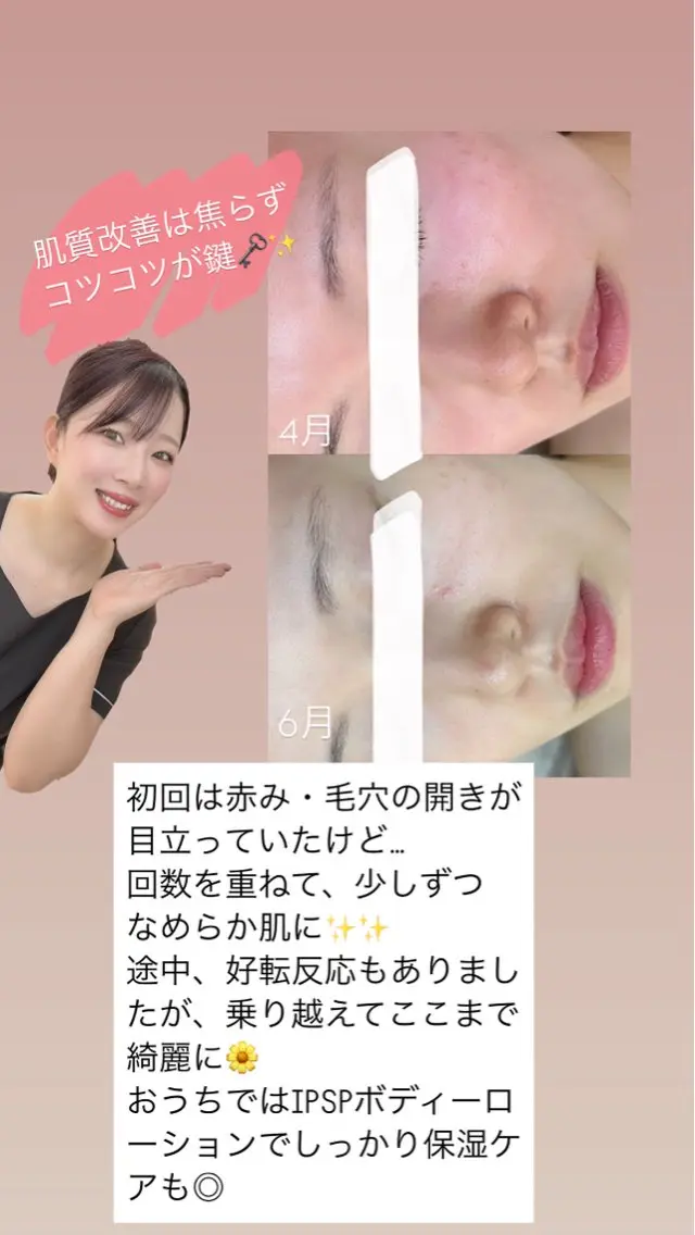 エステ 渡邊 千夏のエステ・リラクイメージ