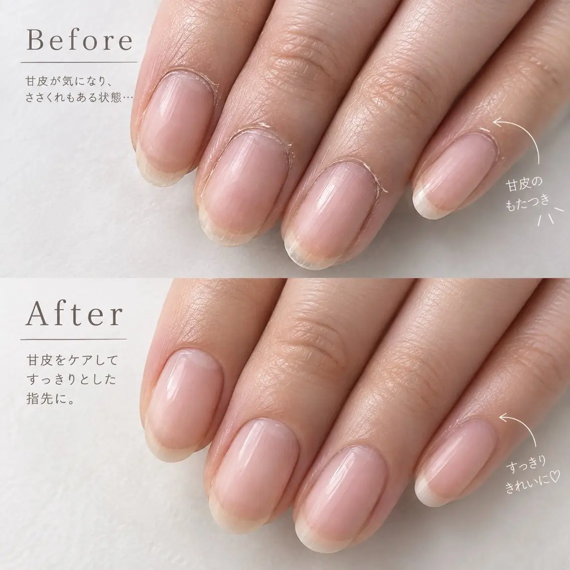 【Jrネイリスト】ネイルケア(ファイリング+甘皮ケア)の写真