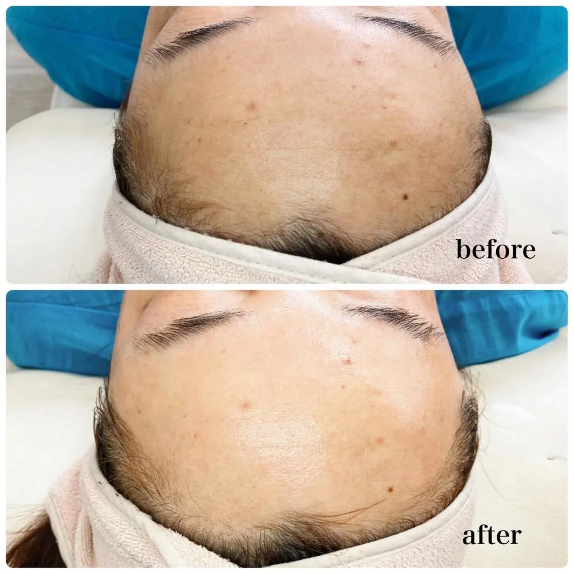 多摩境ViVi chinamiのエステ・リラクイメージ
