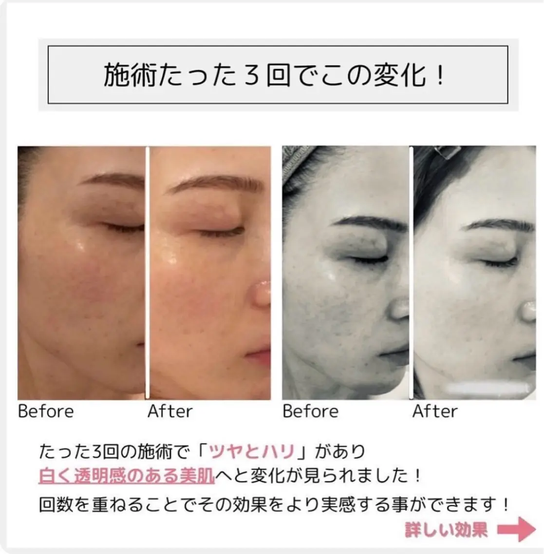ファッショニスタ mihiroのエステ・リラクイメージ