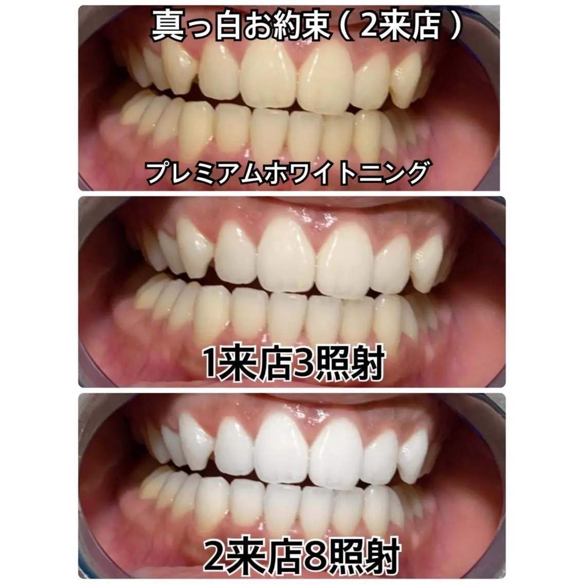 メンズ 【歯科提携】柏ホワイ トニングスタイルのその他イメージ
