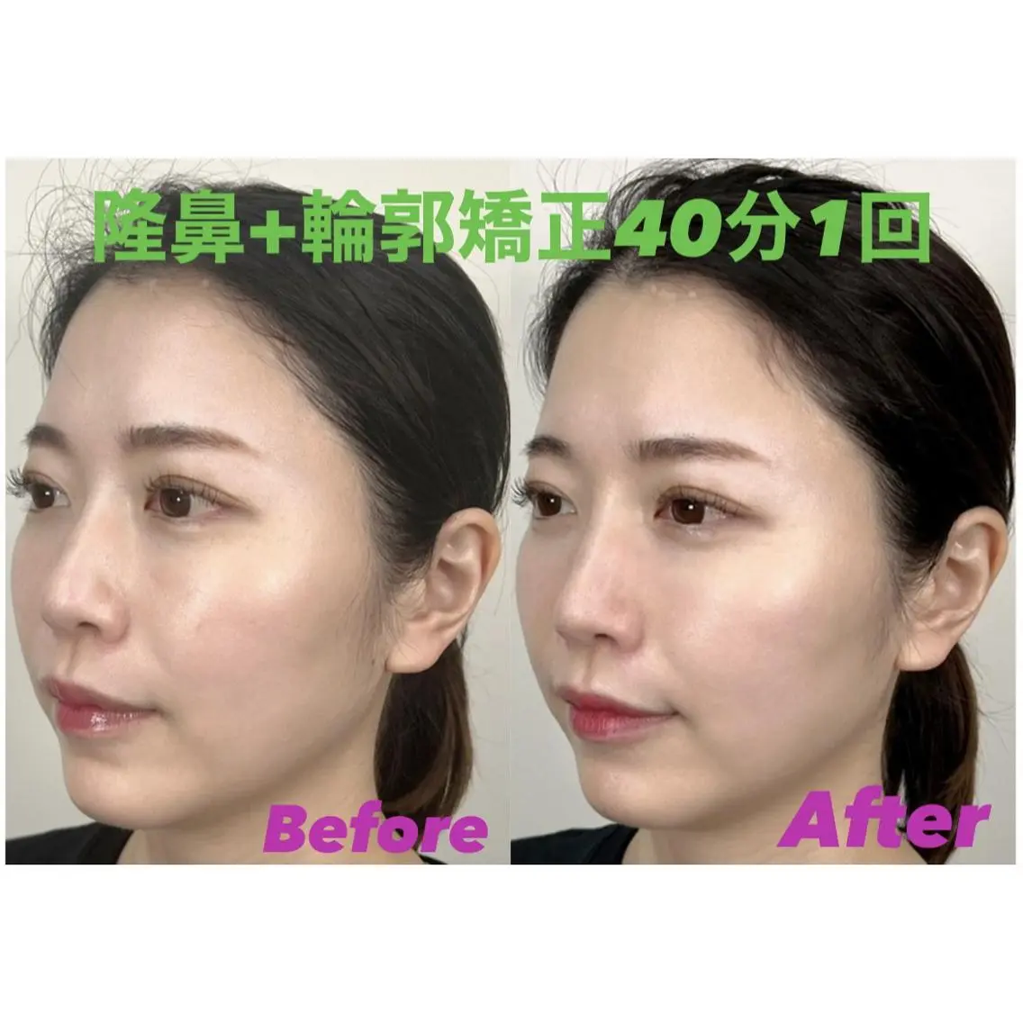 隆鼻矯正専門店ラプリ 佐藤のエステ・リラクイメージ