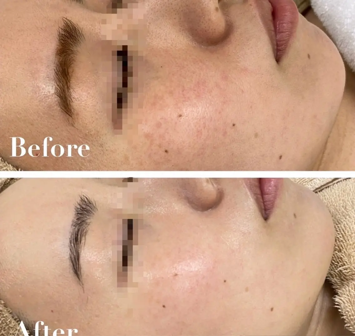 DOUDOU ESTHEのエステ・リラクイメージ