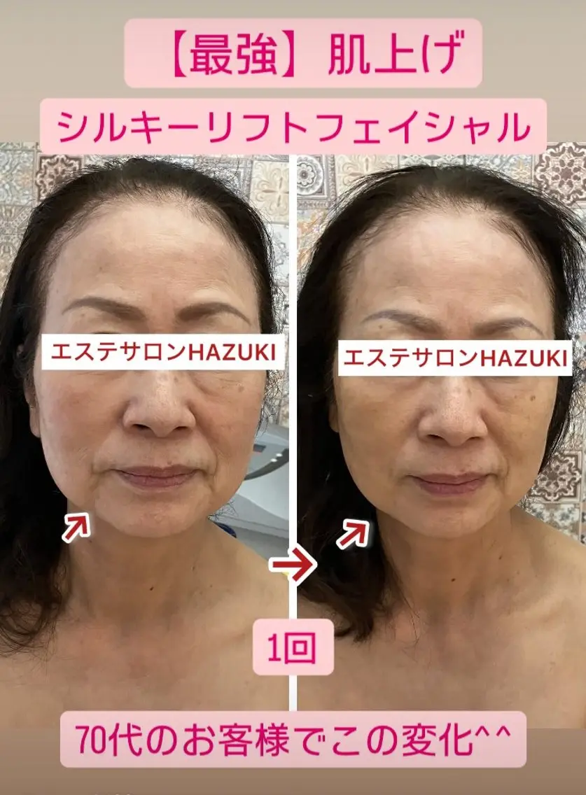たるみ改善小顔エステ 堀葉月のその他イメージ