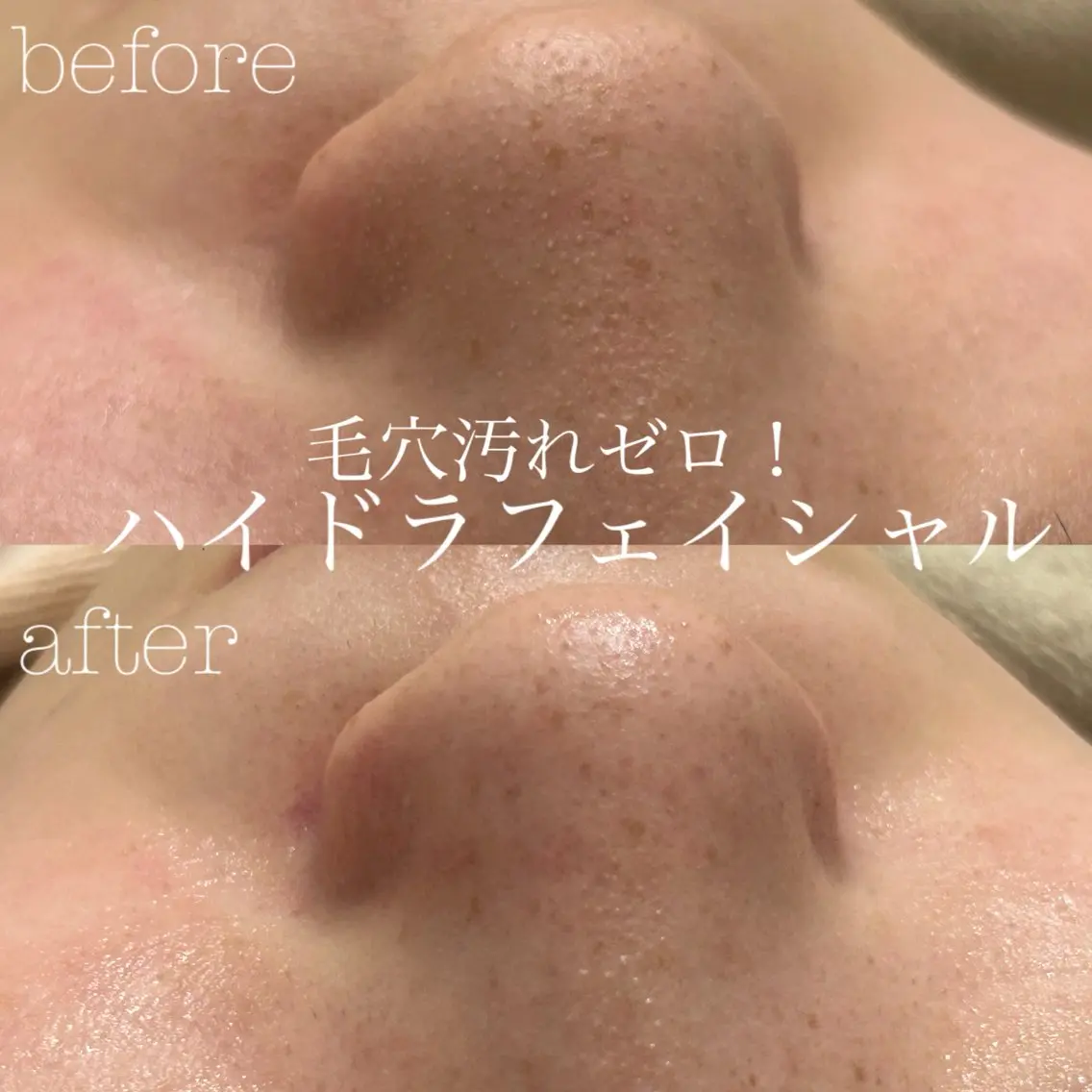 エステ フェイシャルサロン CHIARA 荒田のエステ・リラクイメージ