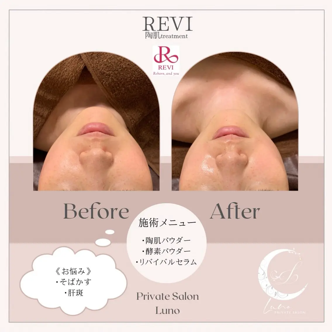 Luno REVI導入サロンのエステ・リラクイメージ