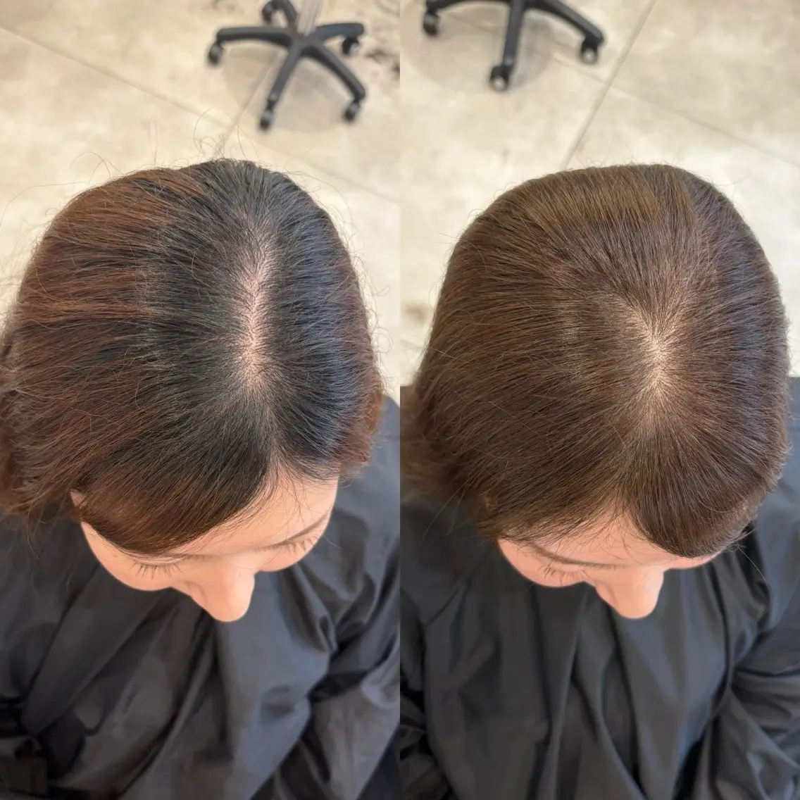 ⭐️生えぐせ改善 ヘアリセッター✂️のヘアスタイル