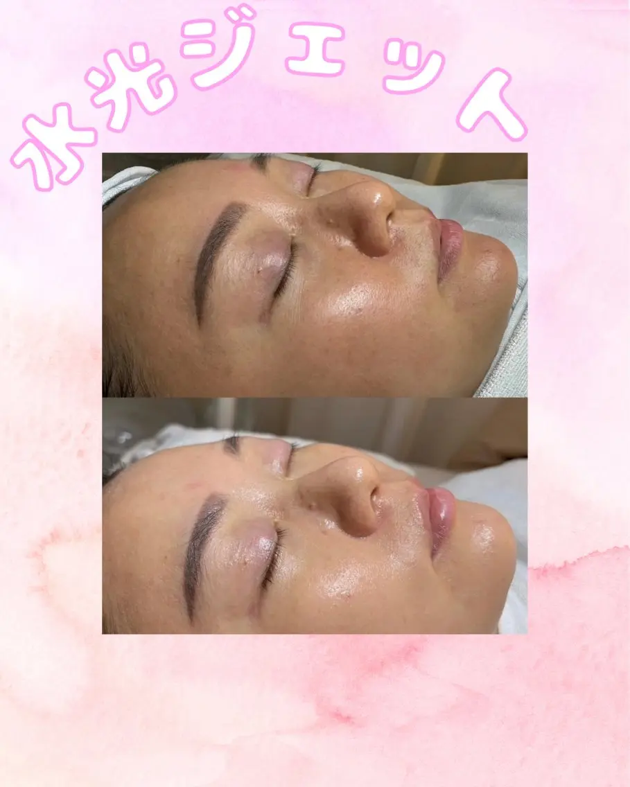 ショート エステ 愛維美水光美肌専門店 メンズレディースokのエステ・リラクイメージ