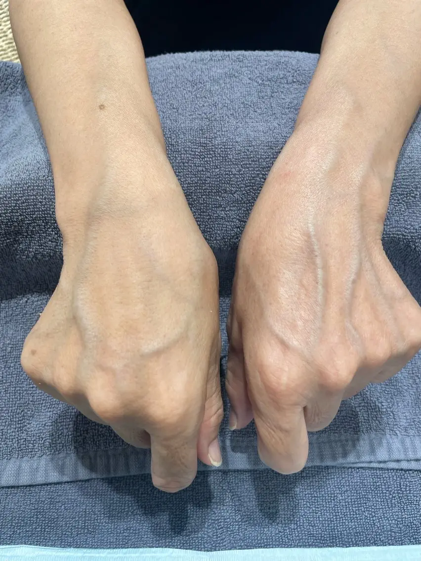老化角質除去！古い角質よ！さようなら！ハンド体験800円の写真