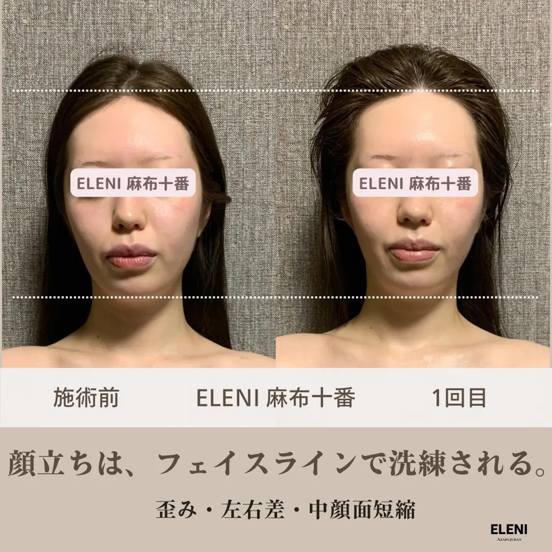 麻布十番小顔コルギ 姿勢矯正リアン💗のエステ・リラクイメージ
