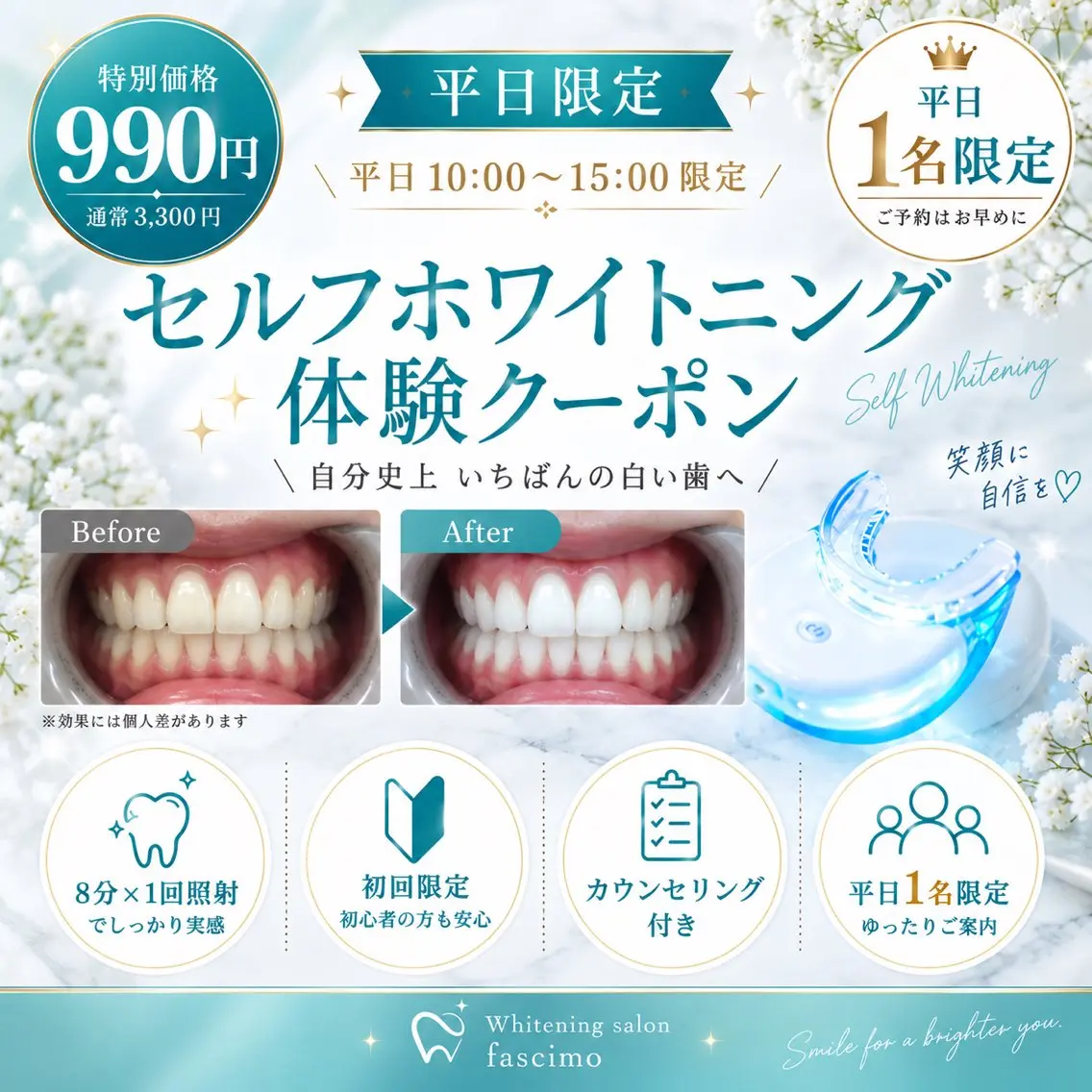 その他 ホワイトニングサロン fascimo新座店のその他イメージ