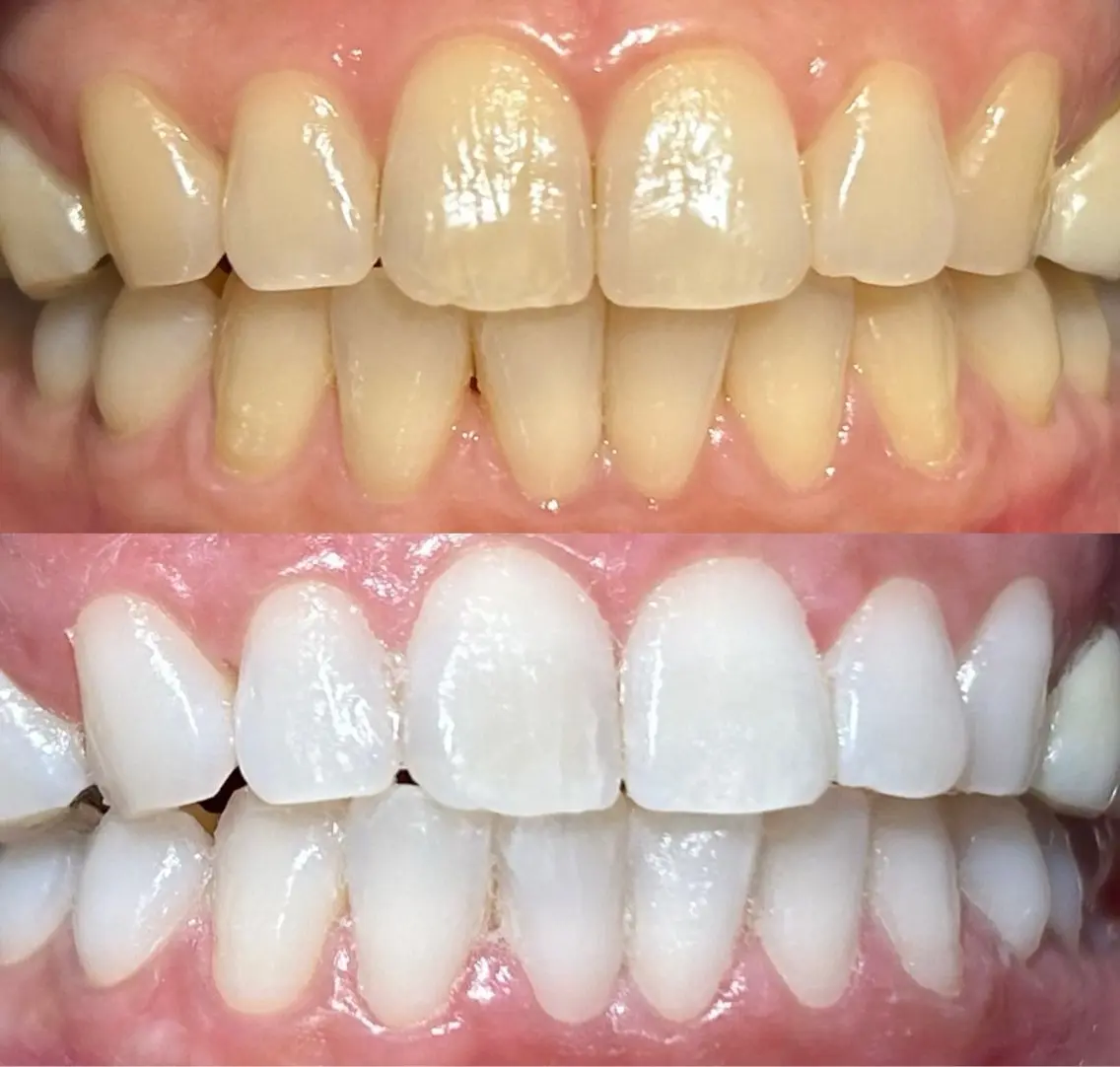 io teeth careのその他イメージ