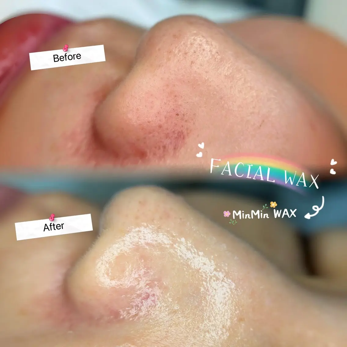 つるんと美肌♪部分フェイシャルWAX♡【選べる1箇所】鼻・顎の写真