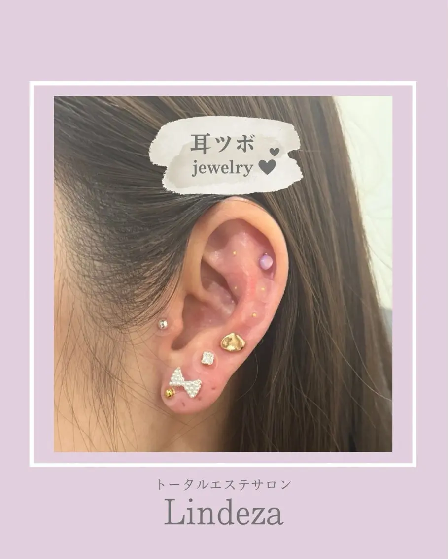 耳ツボジュエリーの写真