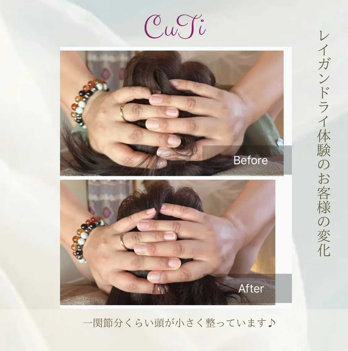 メンズ痛くない頭蓋骨小顔矯正の写真
