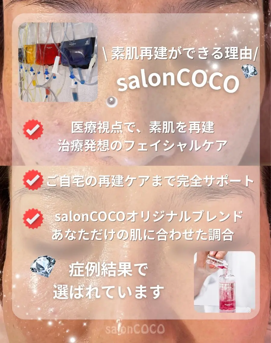 エステ リラク 素肌再建看護師💎 salonCOCOのエステ・リラクイメージ