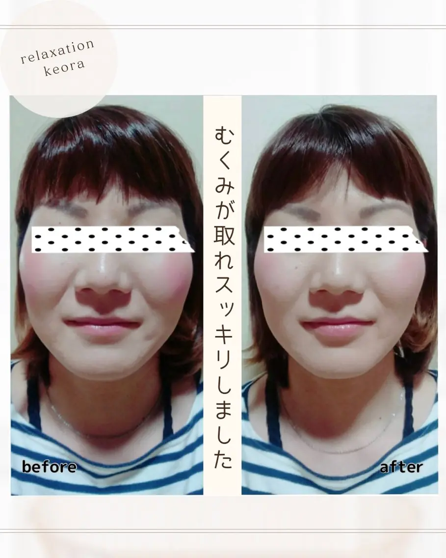 【小顔矯正】 120分の写真