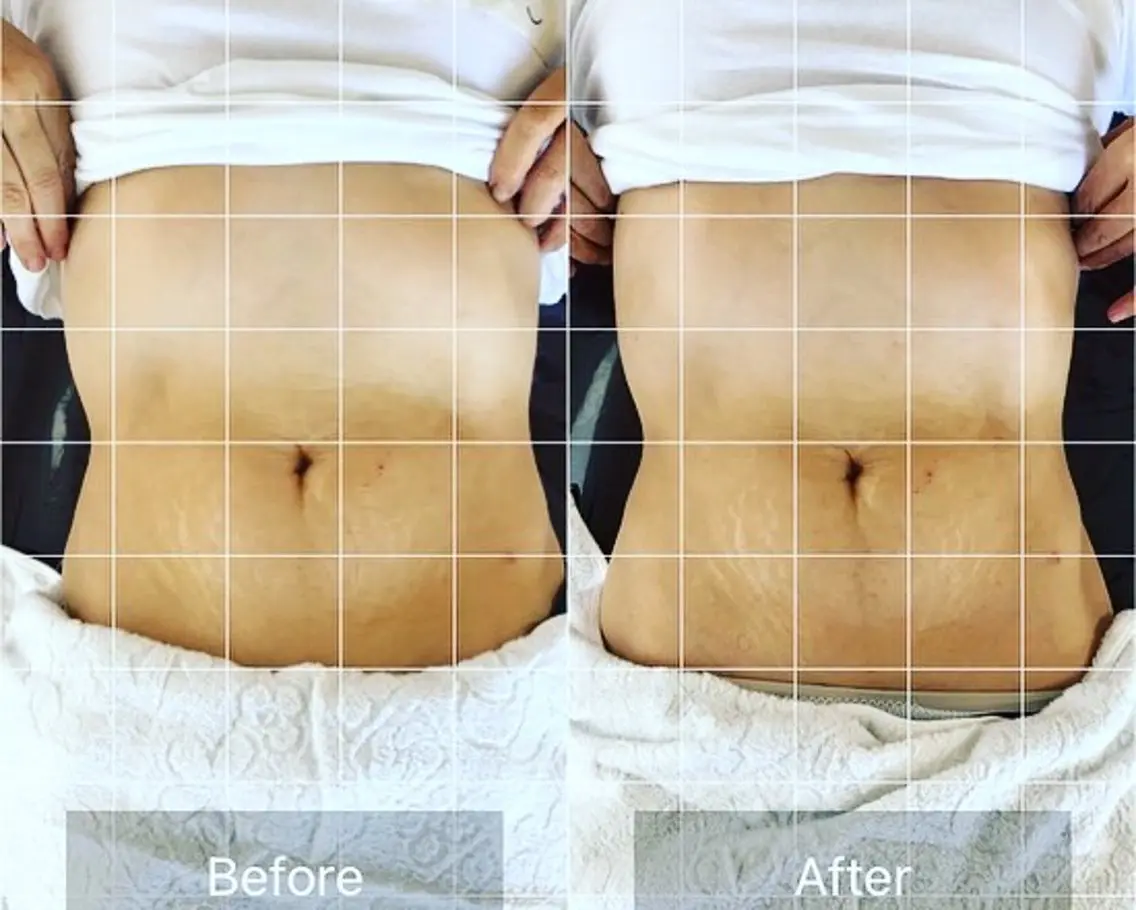内蔵調整ウエスト痩せの写真