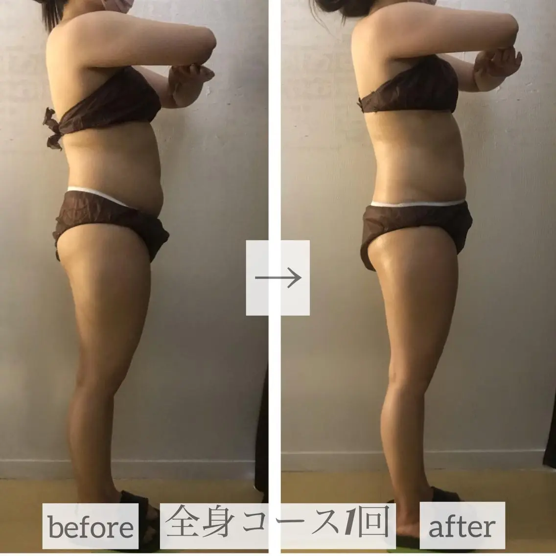 小顔.足痩せ整体 痩身天六Sunaoのその他イメージ