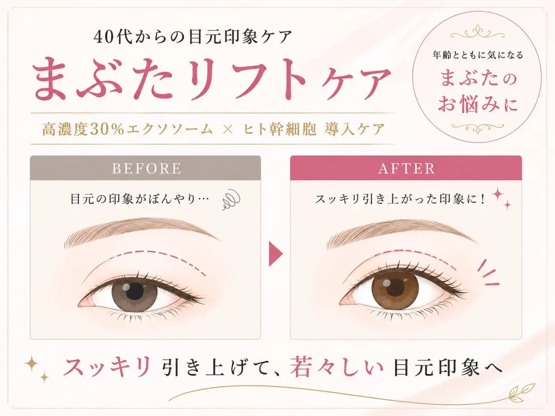当サロン人気メニュー！まぶたリフト★お目元の症例写真にご協力いただける方募集中！※お目元に老化を感じる40代​〜​50代の方の写真