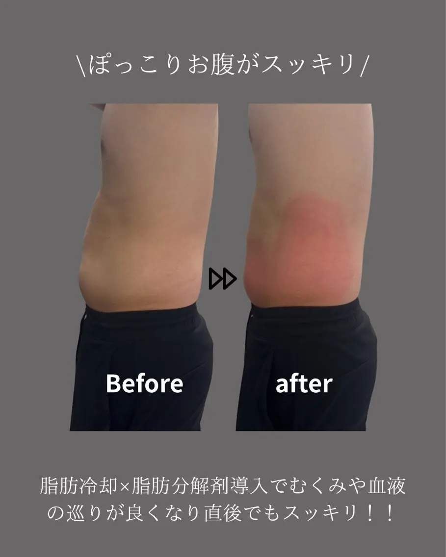 うきわ肉撃退2カップ体験コースの写真