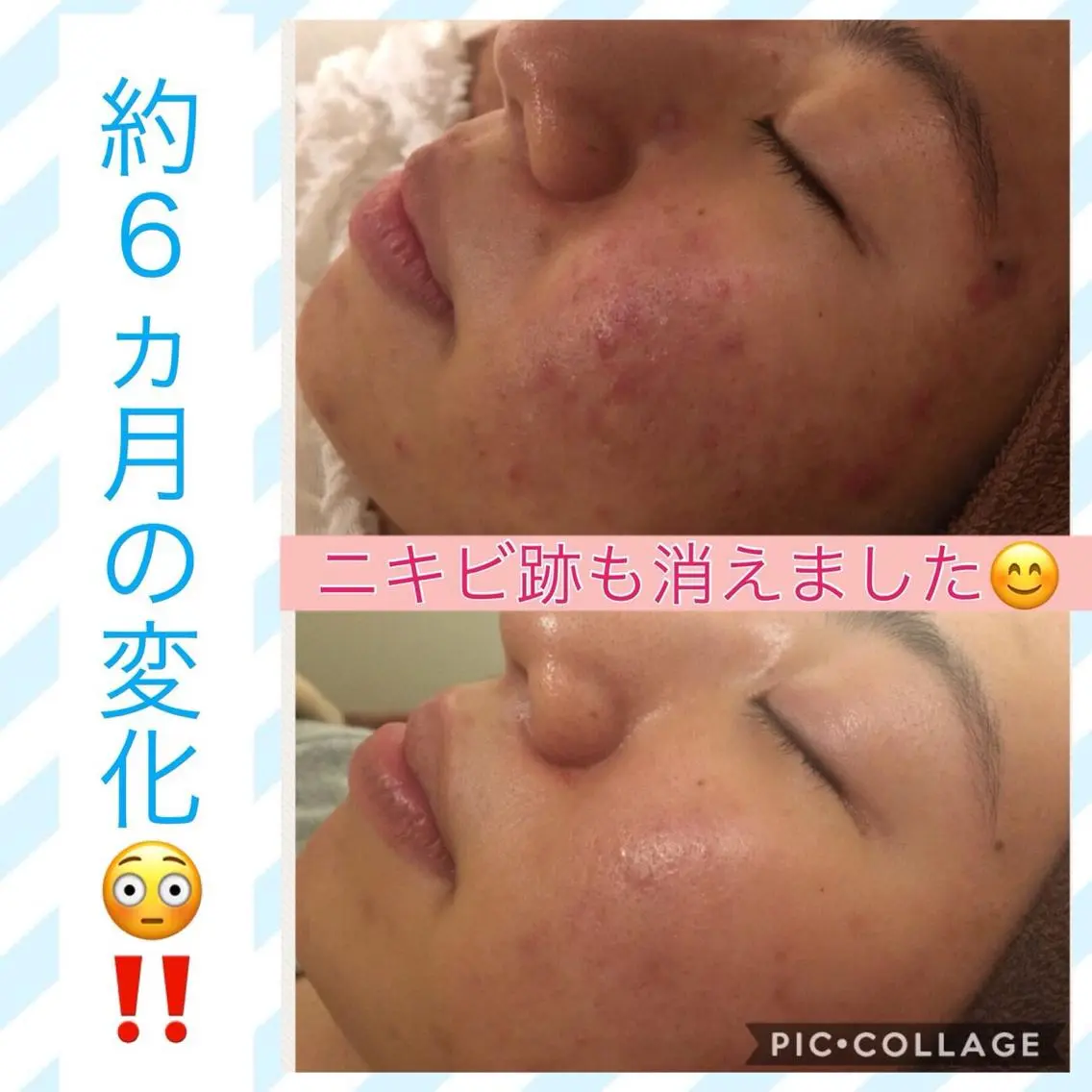 ミディアム カラー パーマ ヘアアレンジ メンズ キッズ ネイル マツエク・マツパ エステ リラク ニキビ・肌質改善専門 ♡人生が変わるサロンのエステ・リラクイメージ