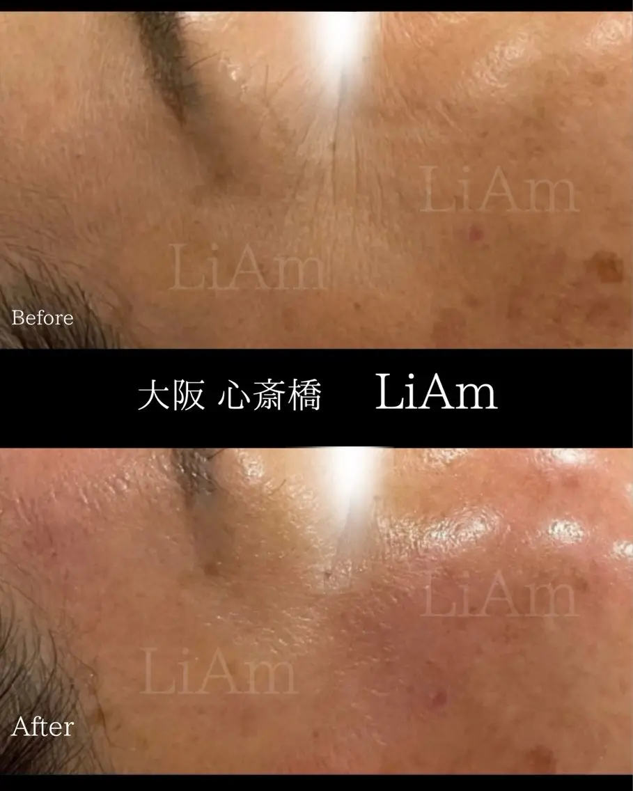 LiAm《韓国管理/ 小顔/脂肪ケア》のエステ・リラクイメージ
