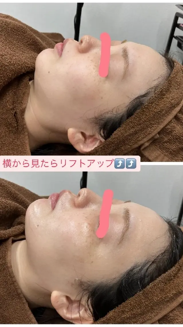 脱毛 JJ  Aiのネイルデザイン