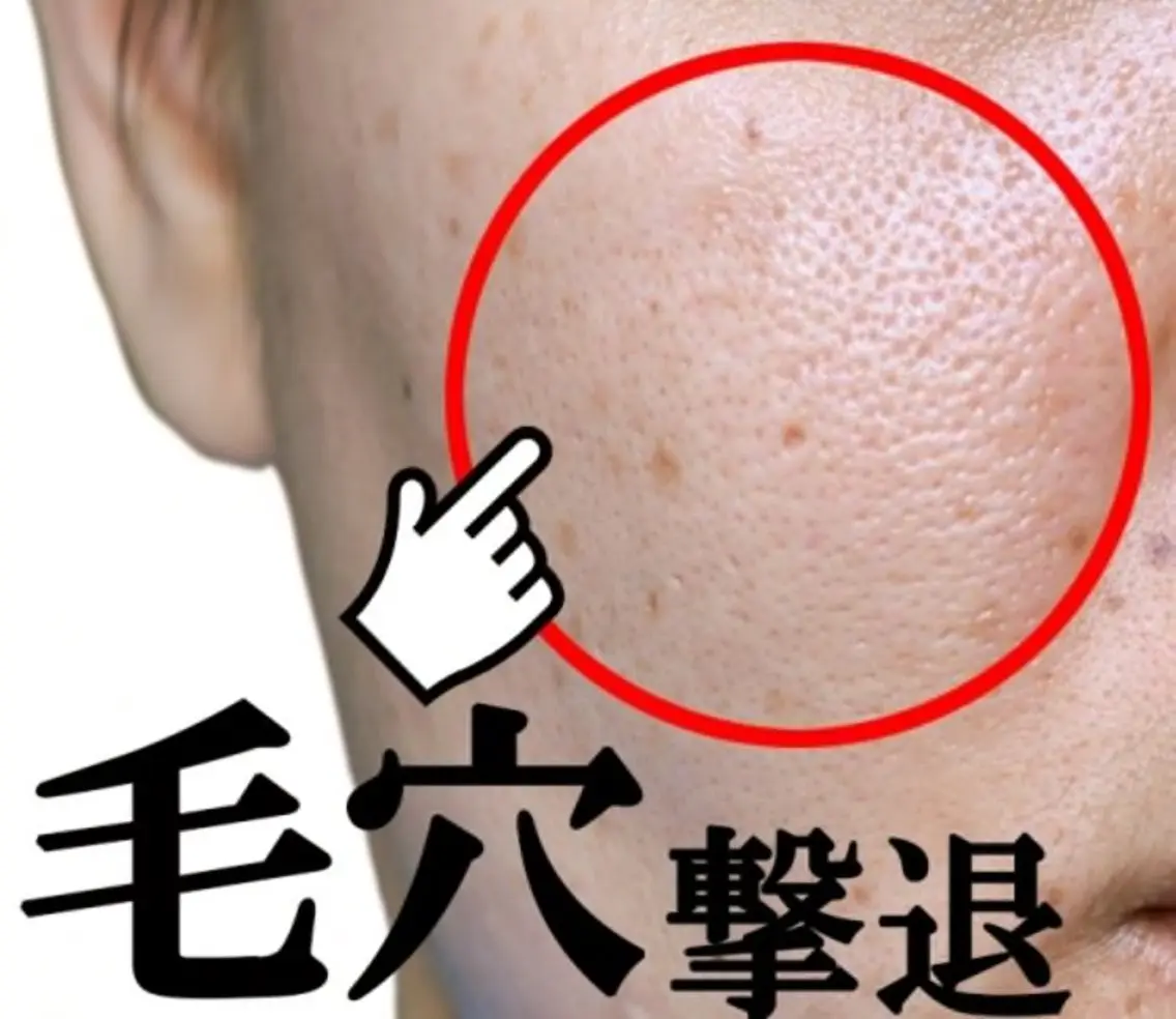 【お日にち限定】5月30日(土)時間:12:00​〜​15:00限定！小鼻の毛穴汚れ撃退！特別無料！の写真