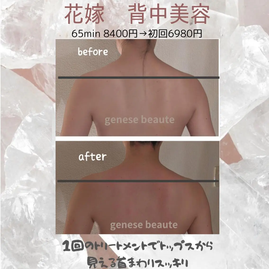 《花嫁美容》お洋服がスッキリ着こなせる　お背中×デコルテ×腕の集中ボディメイク　《重い肩こりにも》の写真