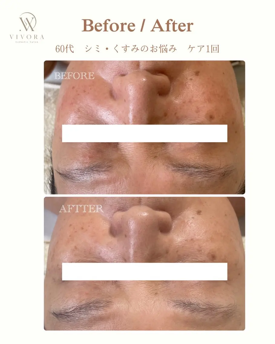 エステ VIVORA ASAMI🌿のエステ・リラクイメージ