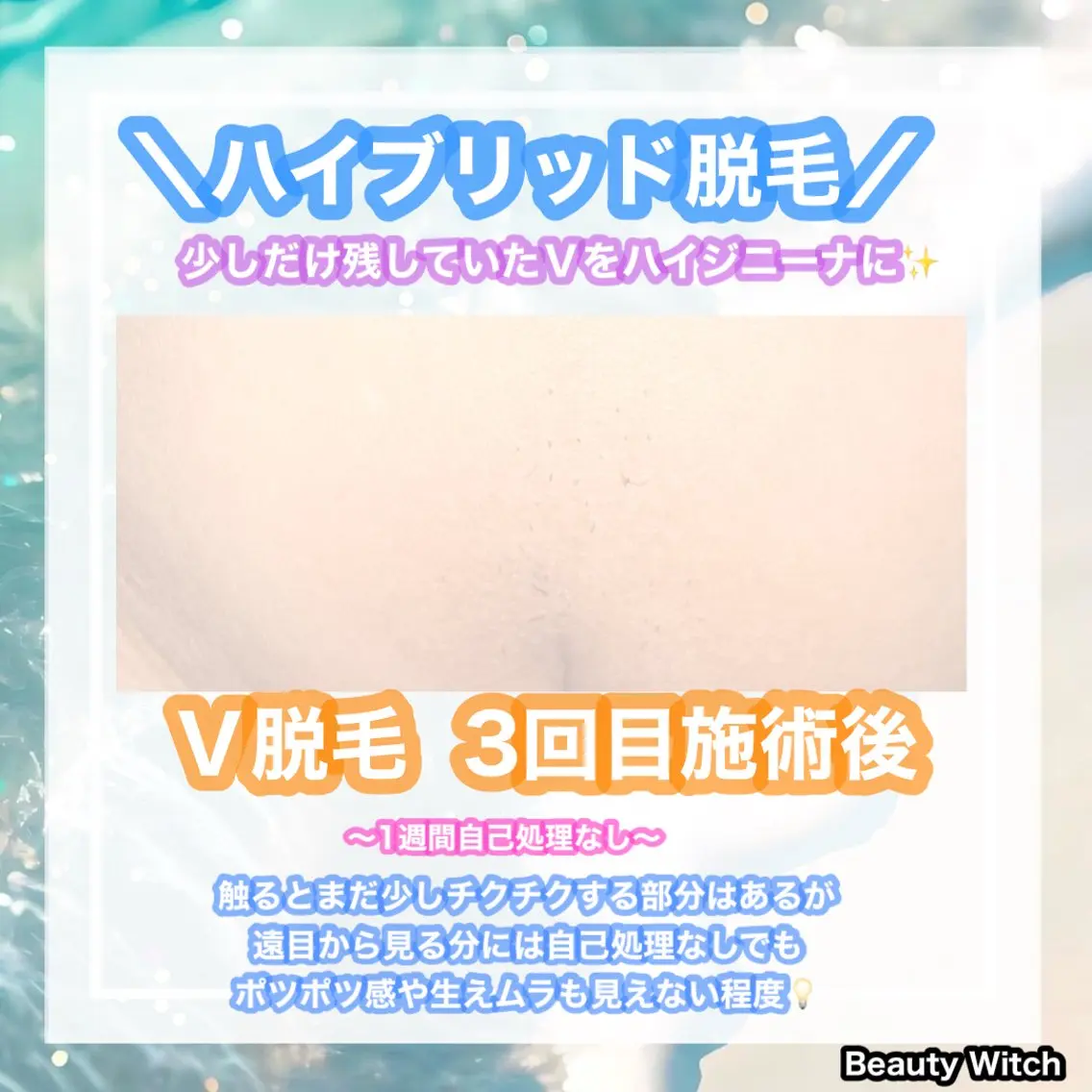 脱毛 痩身/脱毛/ネイル HARUKAのエステ・リラクイメージ