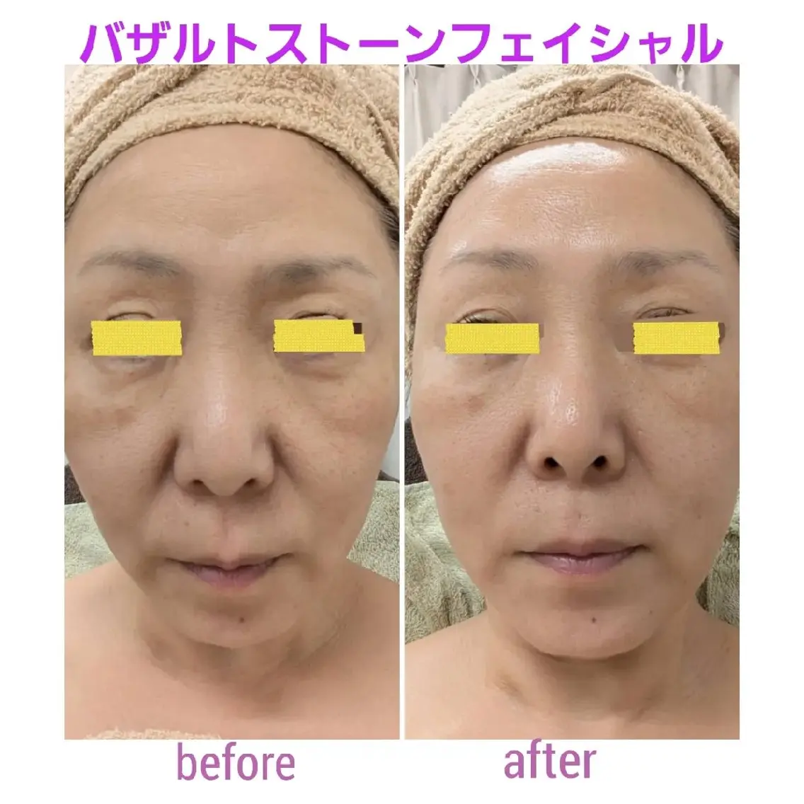 エステ レディースケアサロン Welinaのエステ・リラクイメージ