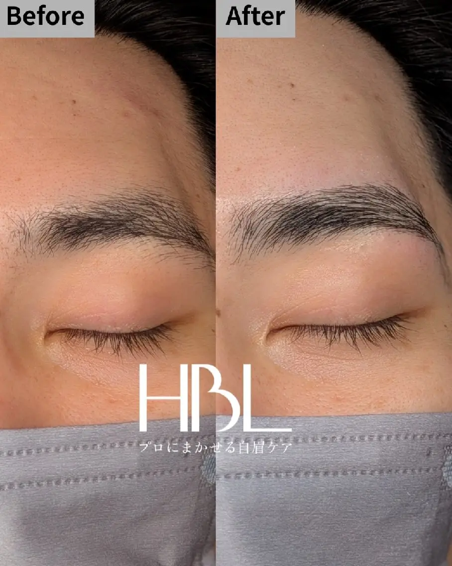 HBL（ワックス脱毛込み）の写真
