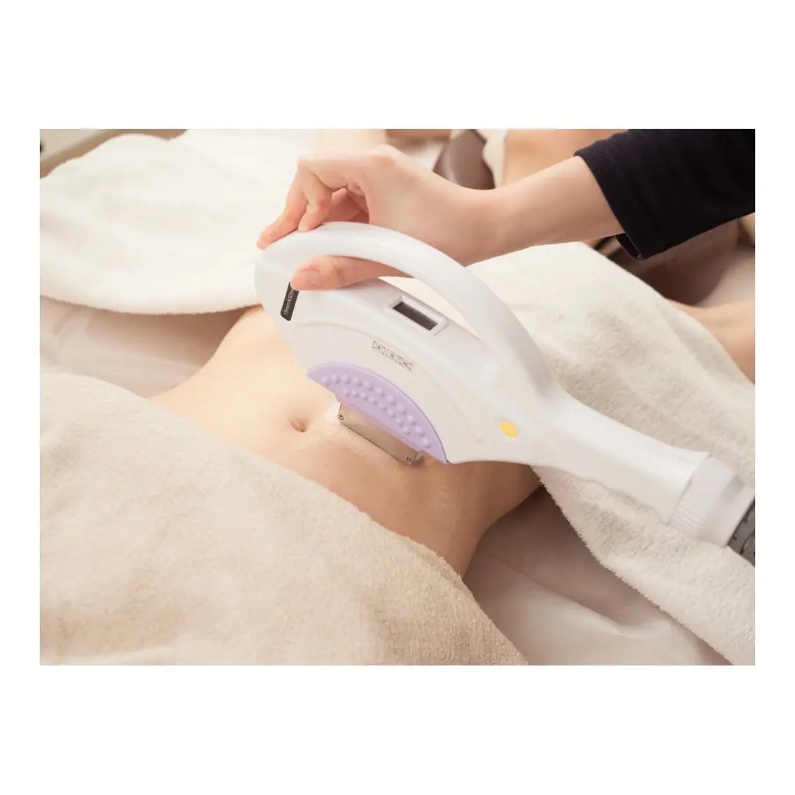 全身（face•うなじ•VIO）ありの写真