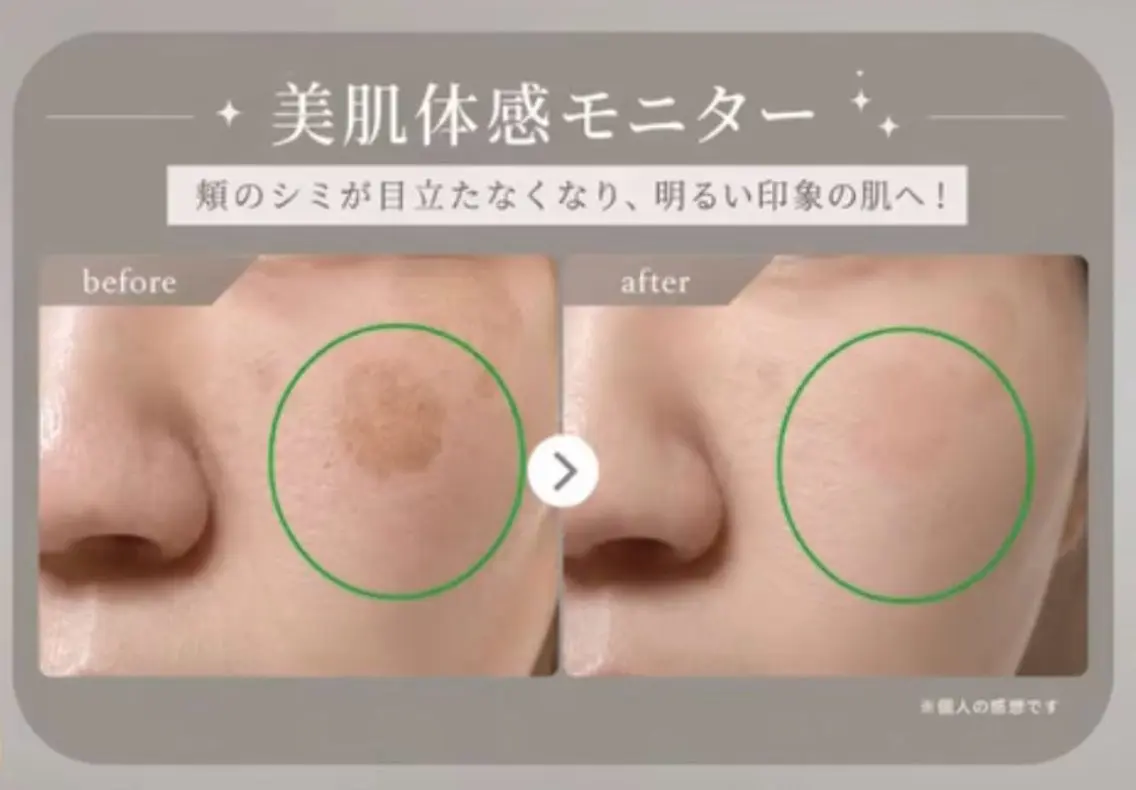 エステ *Lien* リアンのエステ・リラクイメージ